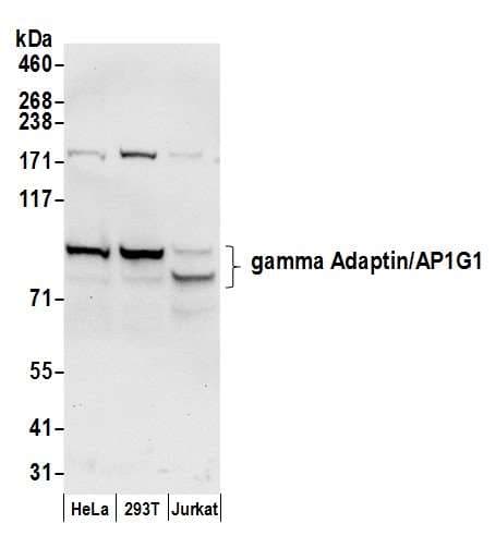 AP1G1 / Adaptin Gamma 1 Antibody (aa1-50)