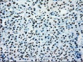 Monoclonal Mouse anti-Human PMEL / SILV / gp100 Antibody (clone OTI10E5, IHC, IF, WB)