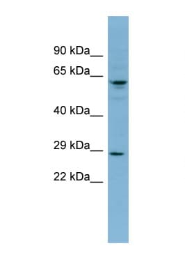 Derlin-3 / DERL3 Antibody (aa71-120)
