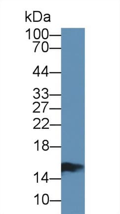 I-FABP / FABP2 Antibody (aa2-128)
