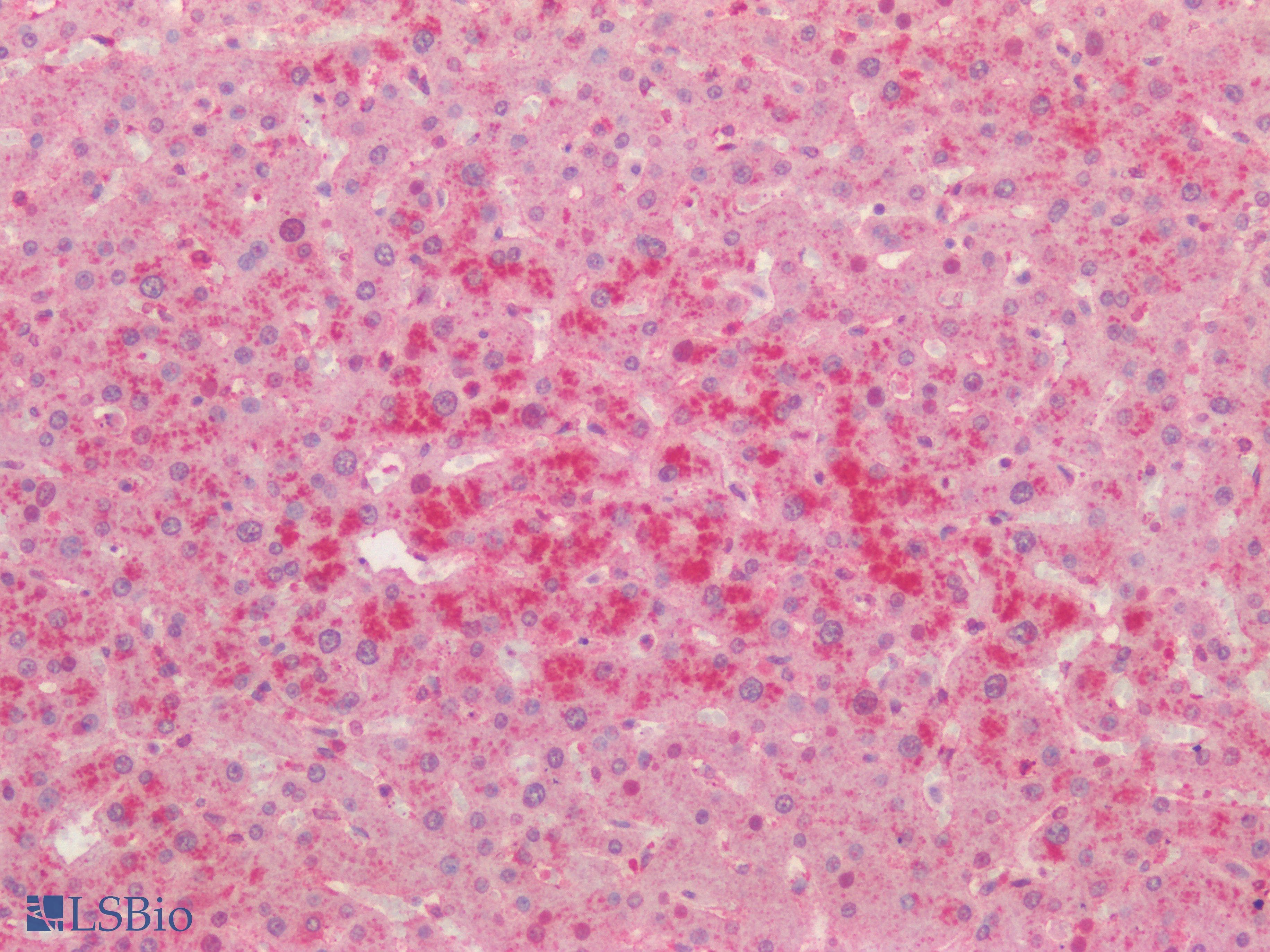 PathPlus™ TNFRSF14 / CD270 / HVEM Antibody