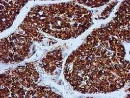 GATM / AGAT Antibody (clone OTI1E3, Carrier-free)