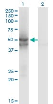 IHC-plus™ Monoclonal Mouse anti-Human IDH2 Antibody (clone 5F11, IHC, WB)