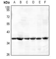 Polyclonal Rabbit anti-Human PRKAB1 / AMPK Beta 1 Antibody (IHC, WB)