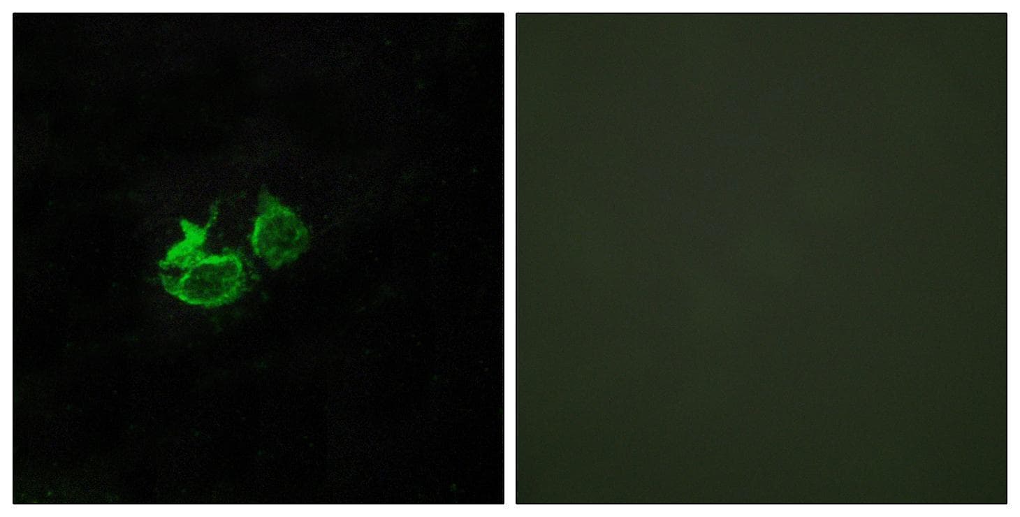 GHRHR Antibody