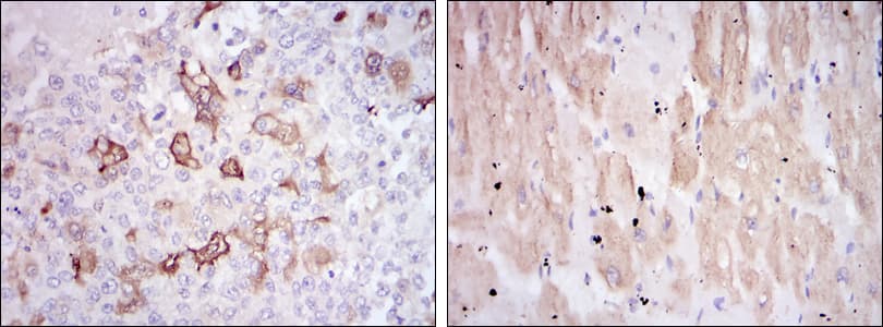 HSPB2 / HSP27 Antibody (clone 5D7)