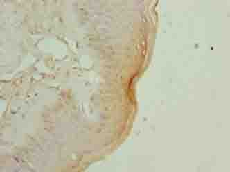 EXOSC1 / CSL4 Antibody