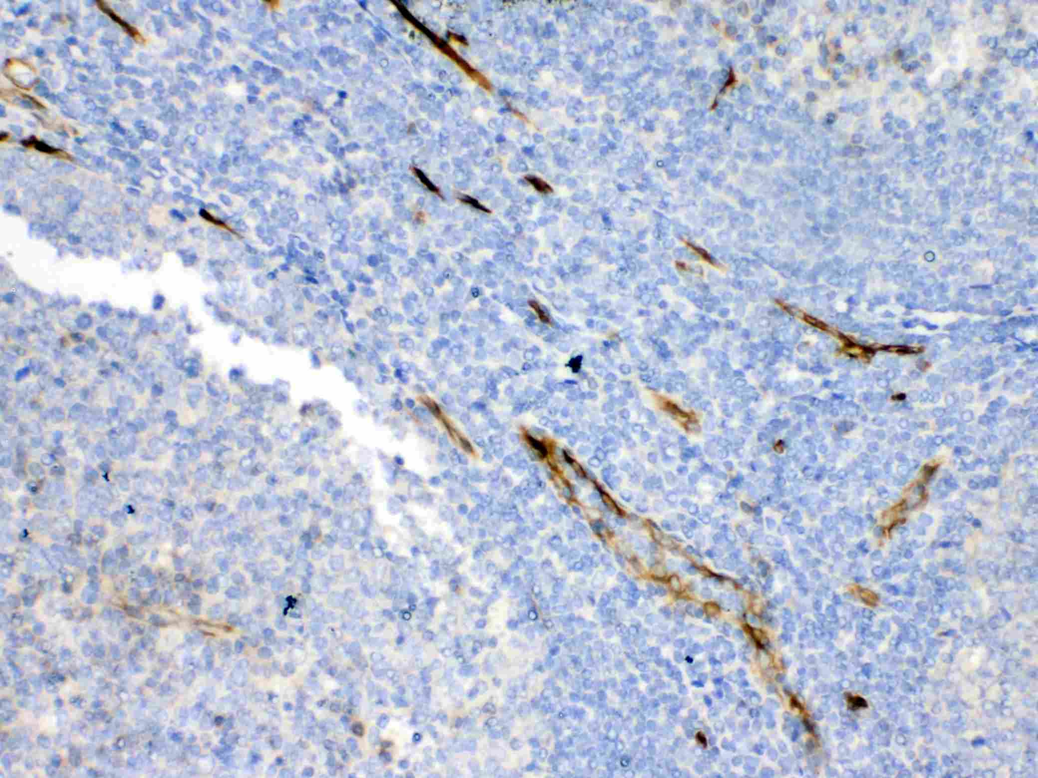 BCL2L1 / BCL-XL Antibody