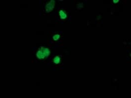 SSX1 Antibody (clone OTI2D12)