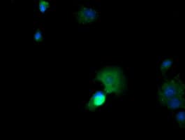 Monoclonal Mouse anti-Human CTAG1B / NY-ESO-1 Antibody (clone OTI5H4, IHC, IF, WB)