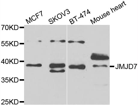 Polyclonal Rabbit anti-Human JMJD7 Antibody (IHC, IF, WB)