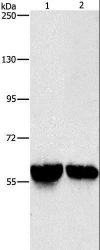 Polyclonal Rabbit anti-Human ALDH8A1 Antibody (IHC, WB)
