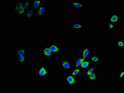 CTSB / Cathepsin B Antibody