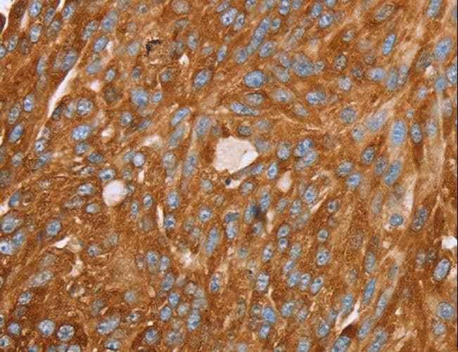 Polyclonal Rabbit anti-Human PAICS / ADE2 Antibody (IHC, WB)