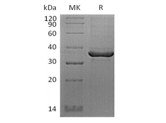 Human FGL1 / Hepassocin Protein (Recombinant AVI-6His, C-terminus)