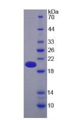 Human PZP Protein (Recombinant His)