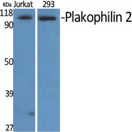 PKP2 / Plakophilin 2 Antibody (610-690 aa, C-terminal)