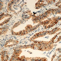 IHC-plus™ Polyclonal Rabbit anti-Human TUSC3 Antibody (Internal, IHC, IF, WB)