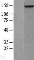 MYBBP1A Protein (Over-Expression Lysate Myc-DDK (Flag))