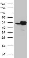 IDH1 / IDH Antibody (clone OTI3G9, Carrier-free)