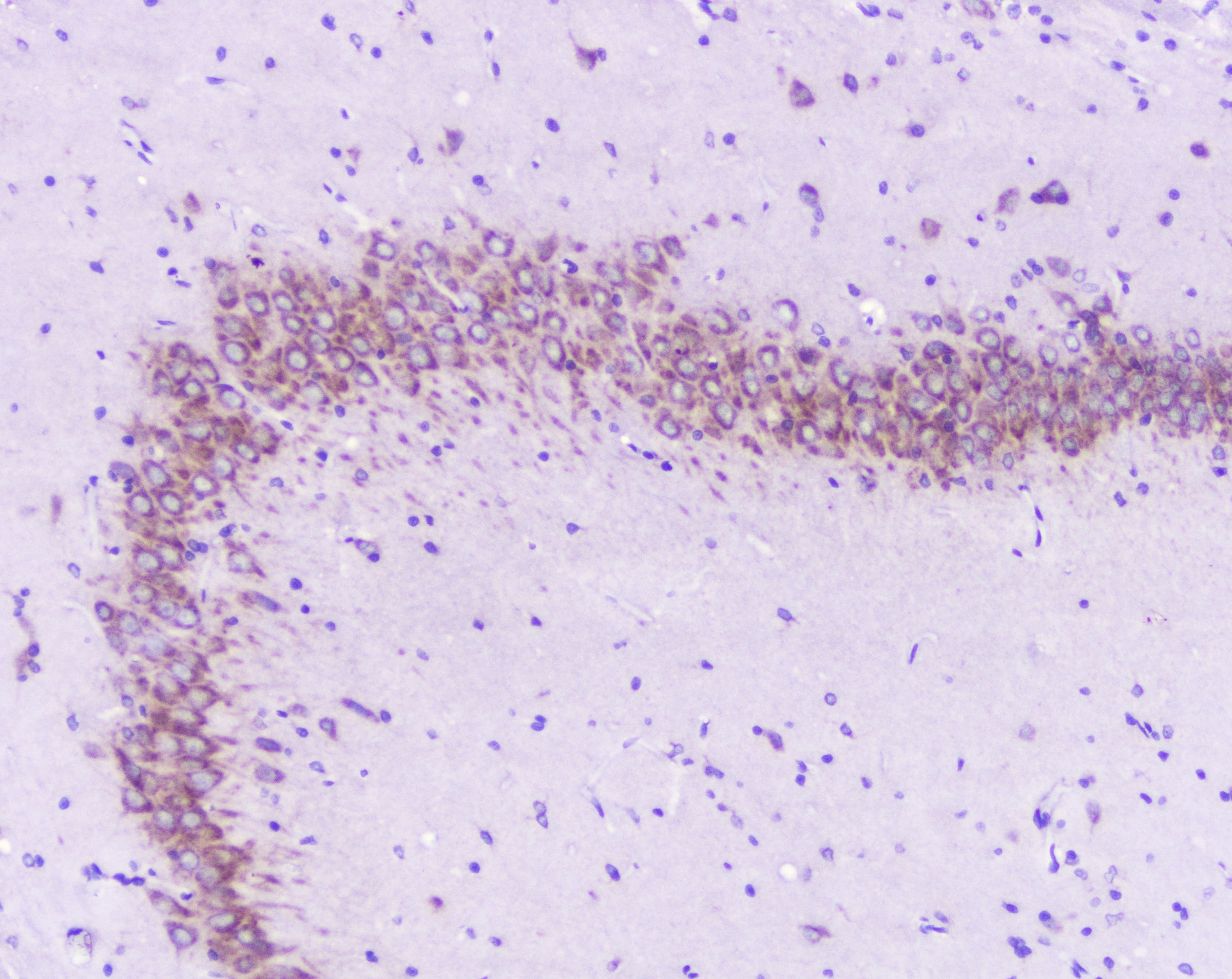Polyclonal Rabbit anti-Human GOLGA2 / GM130 Antibody (IHC, WB)