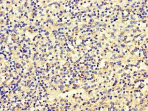 Polyclonal Rabbit anti-Human SBF2 Antibody (IHC, IF)