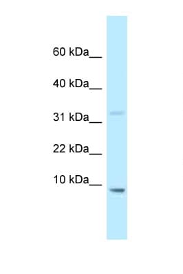 HMGN2 Antibody (N-Terminus)