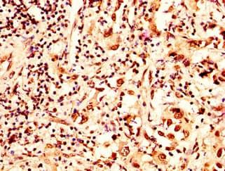 HIST1H2AI Antibody