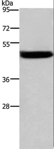 CTSE / Cathepsin E Antibody