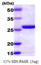 Human AK2 / Adenylate Kinase 2 Protein (Recombinant His)