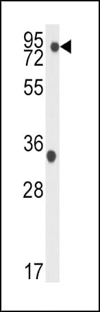 NAK / TBK1 Antibody (Ser172)