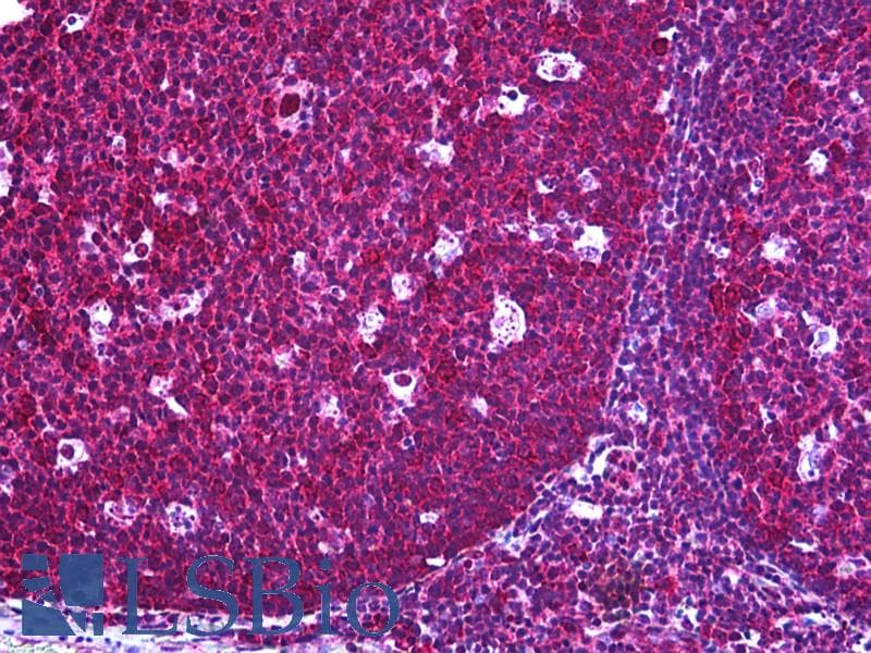 IHC-plus™ CFLAR / FLIP Antibody (clone 2F12)