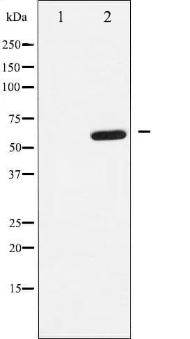 DOK1 Antibody (phospho-Tyr398)