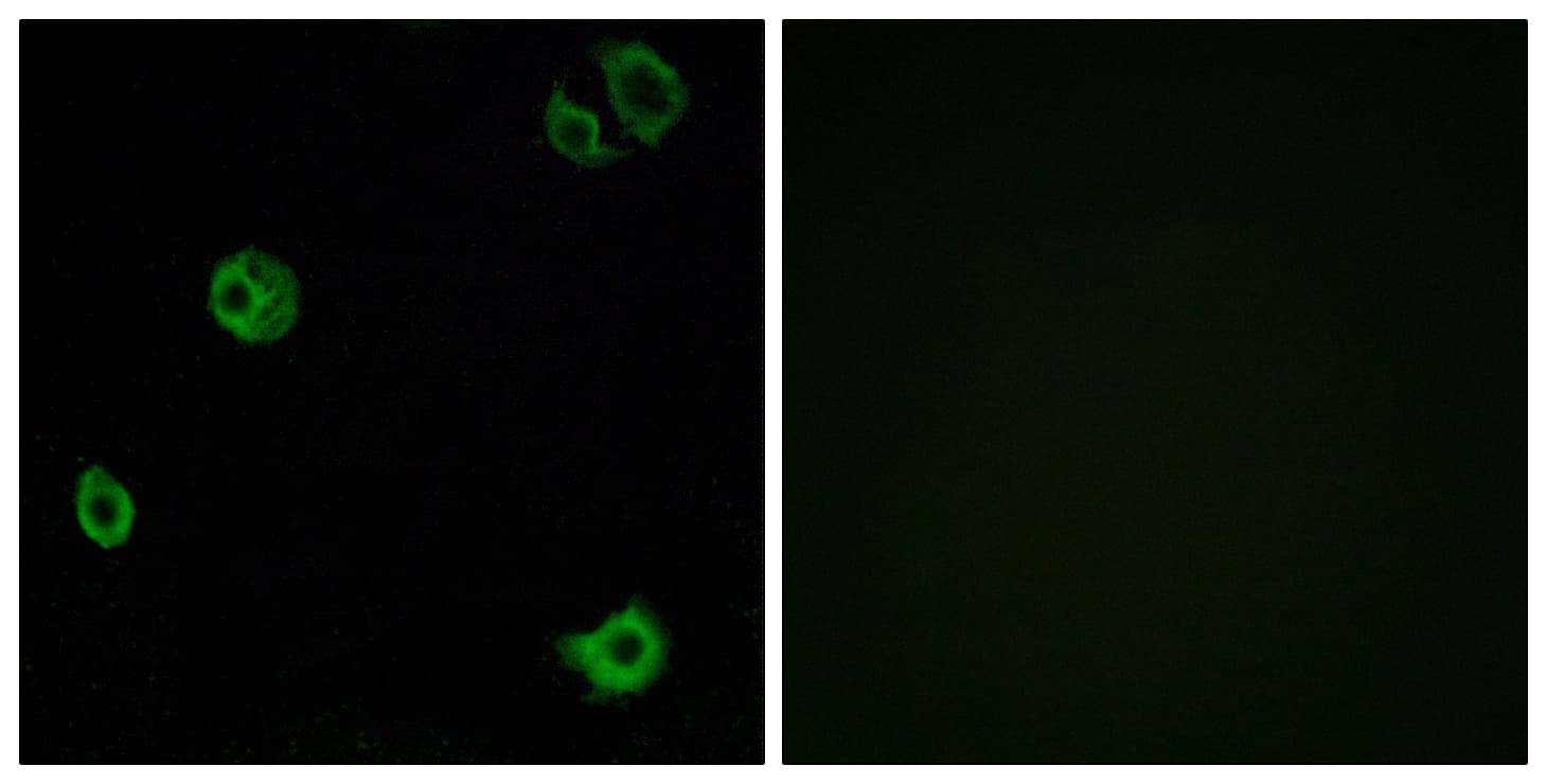 Polyclonal Rabbit anti-Human ADGRF1 / GPR110 Antibody (aa831-880, IF, WB)