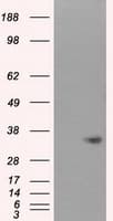 NIT1 Antibody (clone OTI4D12)