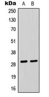 Polyclonal Rabbit anti-Human CLIC4 Antibody (N-Terminus, IHC, WB)