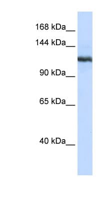 PLA2G4B Antibody (N-Terminus)