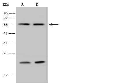RBM34 Antibody
