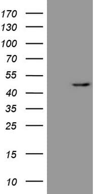 IHC-plus™ REN / Renin 1 Antibody (aa131-406, clone 1D3)