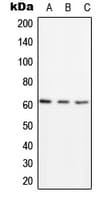 Polyclonal Rabbit anti-Human p58 / PSMD3 Antibody (Internal, WB)