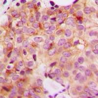 GAK Antibody (N-Terminus)
