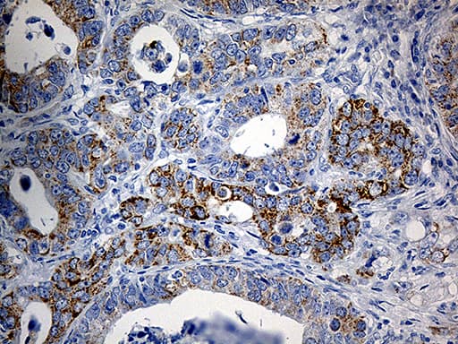 Monoclonal Mouse anti-Human PYCR1 Antibody (clone OTI4F2, aa1-319, IHC, WB)