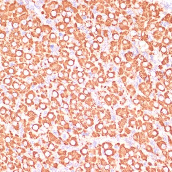 MAP2K3 / MEK3 / MKK3 Antibody