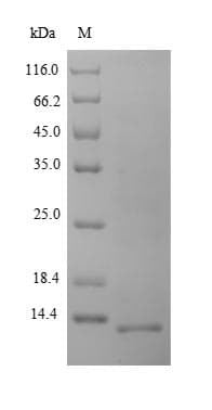 Porcine Reproductive and Respiratory Syndrome Viru ORF7 Protein (Recombinant)