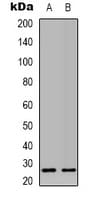 Polyclonal Rabbit anti-Human MRRF Antibody (C-Terminus, IHC, WB)