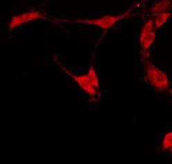 EPHX4 / Epoxide Hydrolase 4 Antibody