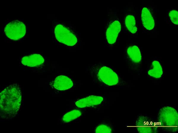 Monoclonal Mouse anti-Human TSPYL1 Antibody (clone 4F11, IF, WB)