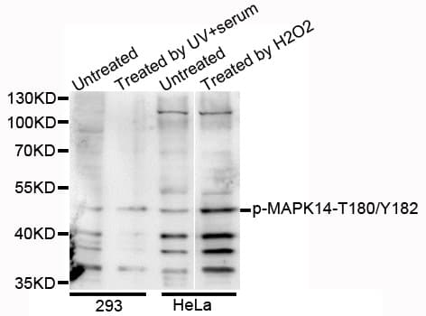 MAPK14 / p38 Antibody (phospho-Thr180/Tyr182, AP)