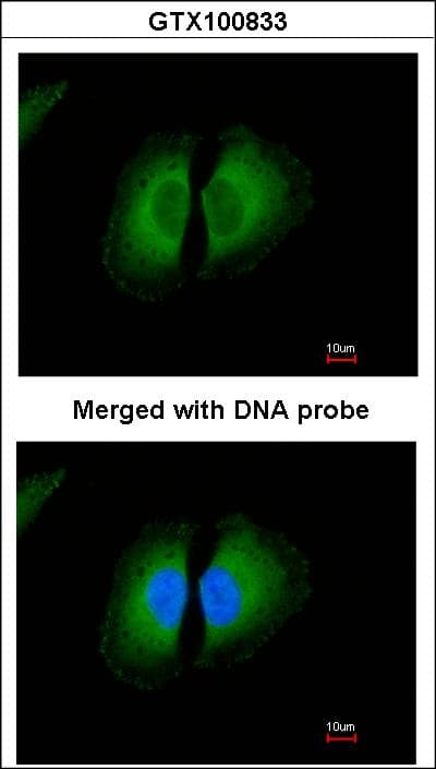 PathPlus™ KNG1 / Kininogen / Bradykinin Antibody (aa1-416)