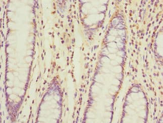 Polyclonal Rabbit anti-Human TIMM17A / TIM17 Antibody (IHC)